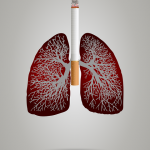 علاج التهاب الرئة للمدخنين